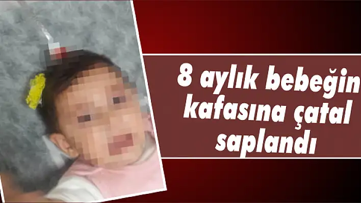 8 aylık bebeğin kafasına çatal saplandı