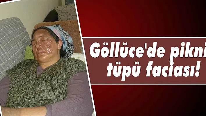 Göllüce'de piknik tüpü faciası!