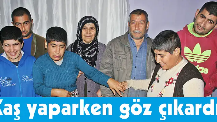 Kaş yaparken göz çıkardı!